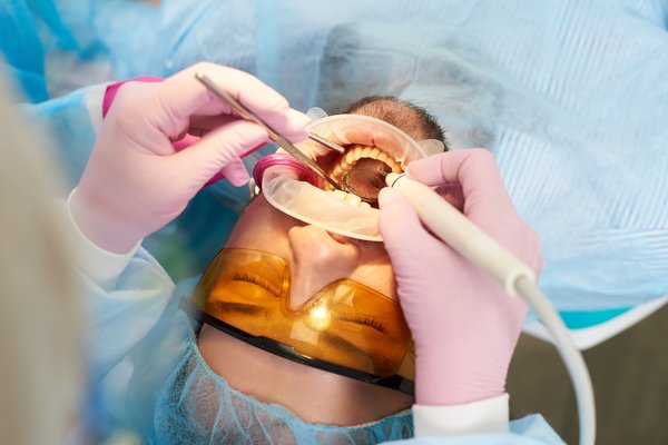 Détartreur dentaire : la clé pour un sourire éclatant à la maison